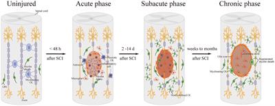 The therapeutic potential of microRNAs to ameliorate spinal cord injury by regulating oligodendrocyte progenitor cells and remyelination